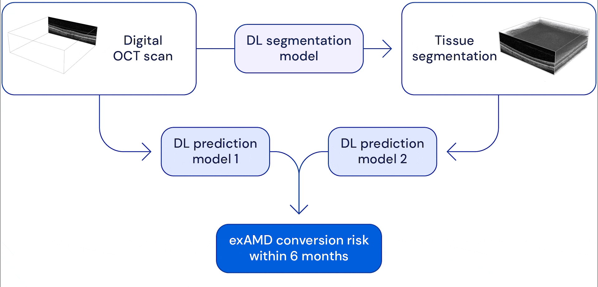 Using AI to predict retinal disease progression